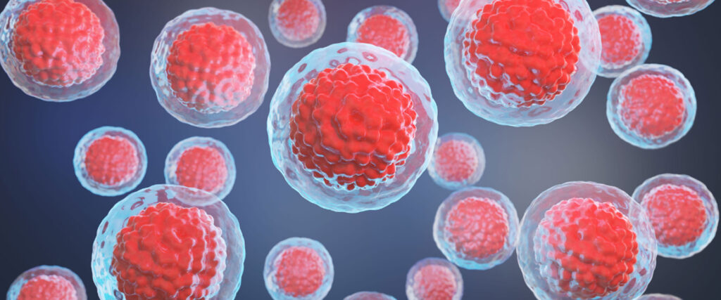 3 therapeutische apherese zur unterstutzung bei chronischen krankheiten